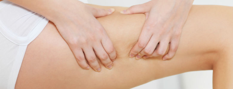 How Can I Get Rid of Cellulite?